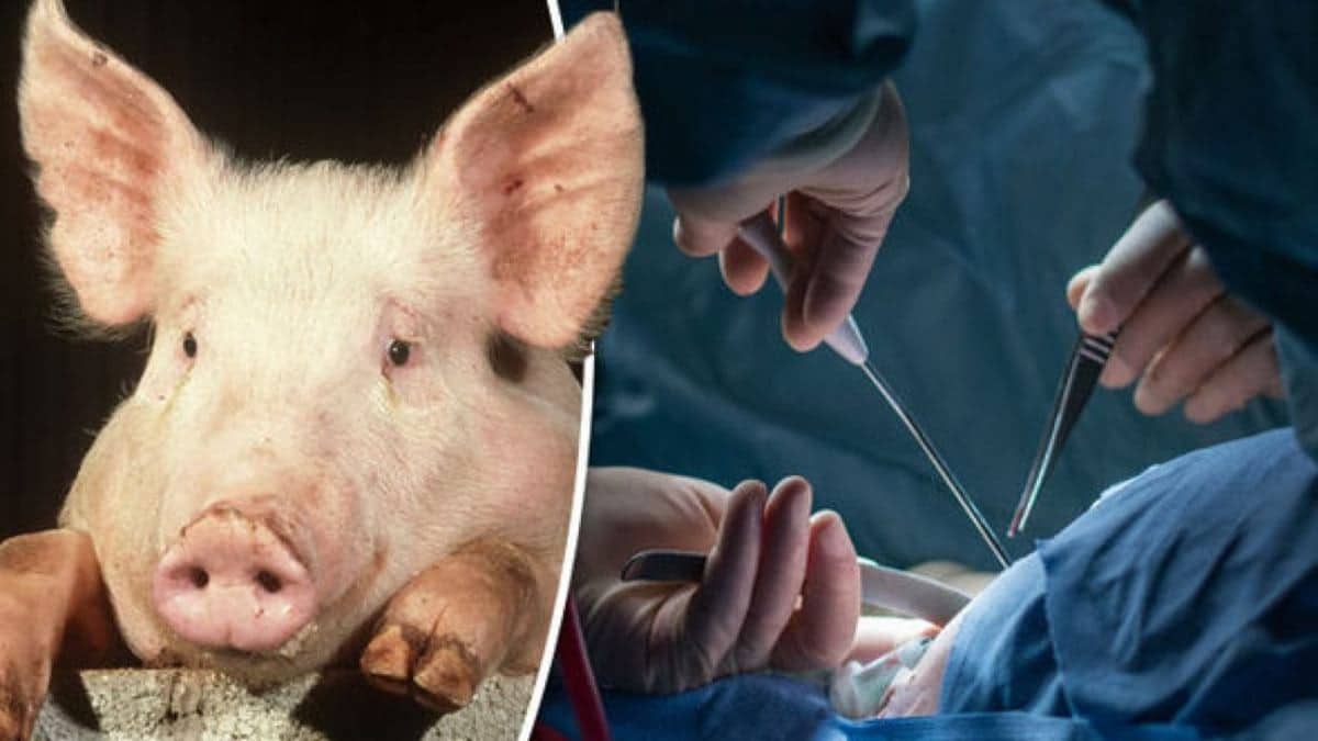 Cerdos modificados genéticamente falla real dialisis hemodialisis SERME